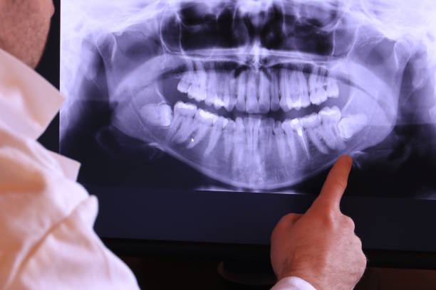 Best Emergency Dentist for Special Needs Patients in Clarinda, IA