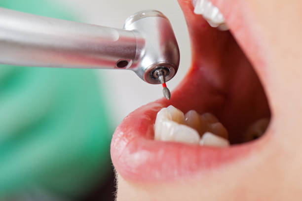 Best Broken or Cracked Tooth Emergency Dentist in Clarinda, IA